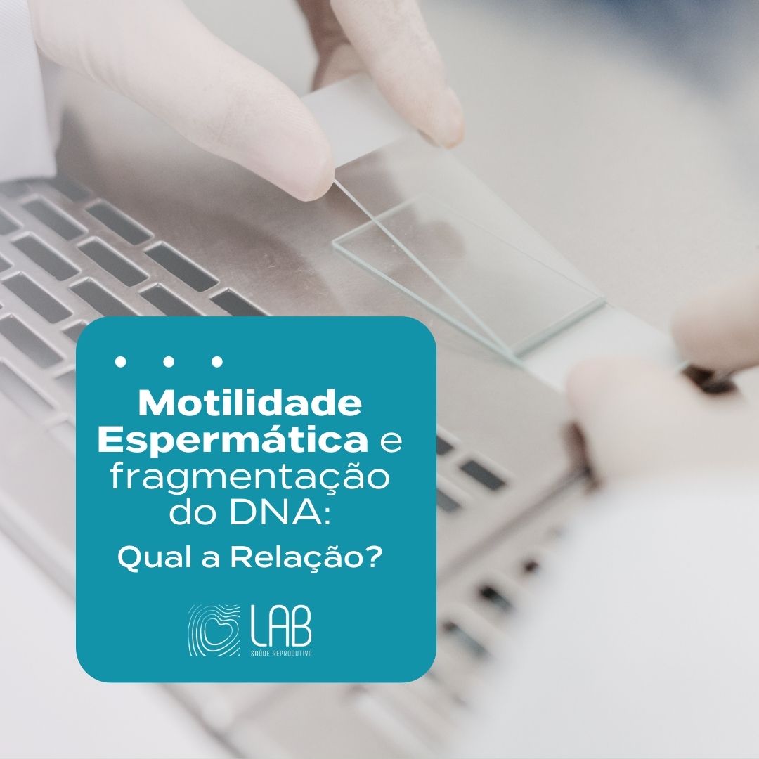 motilidade espermática