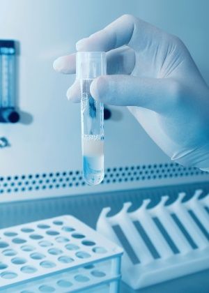 Criação de espermatozoides in vitro