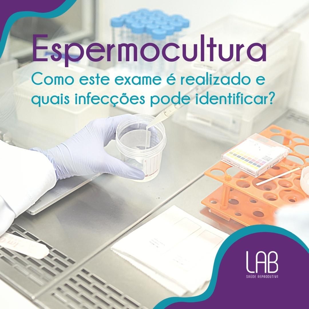 espermocultura