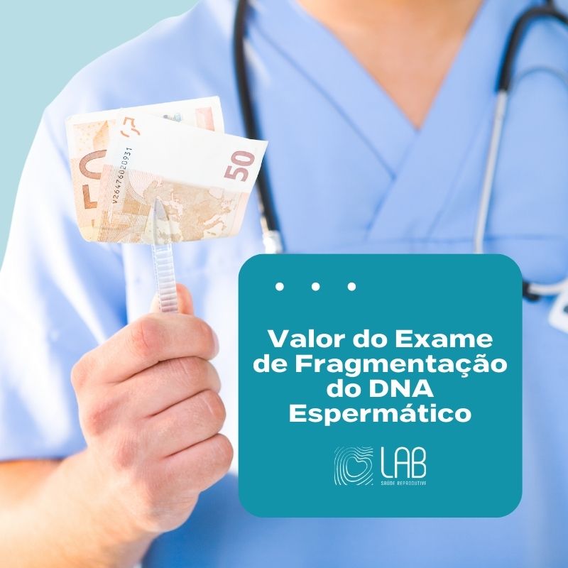 Valor do Exame de Fragmentação do DNA Espermático