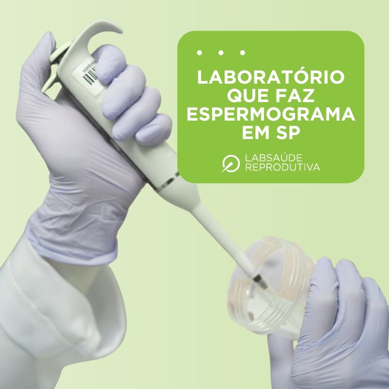 Laboratório que Faz Espermograma em SP