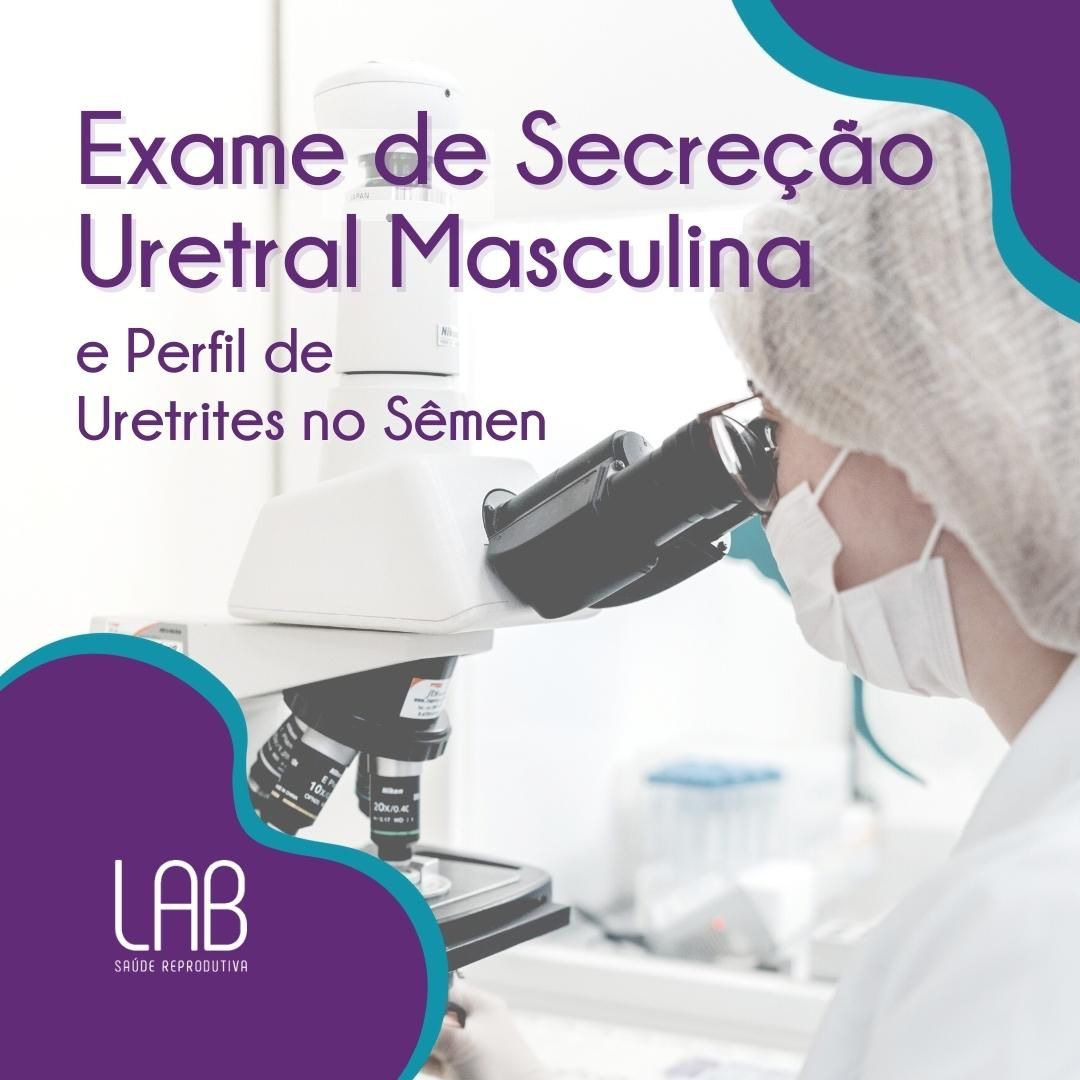 Exame de Secreção Uretral Masculina 