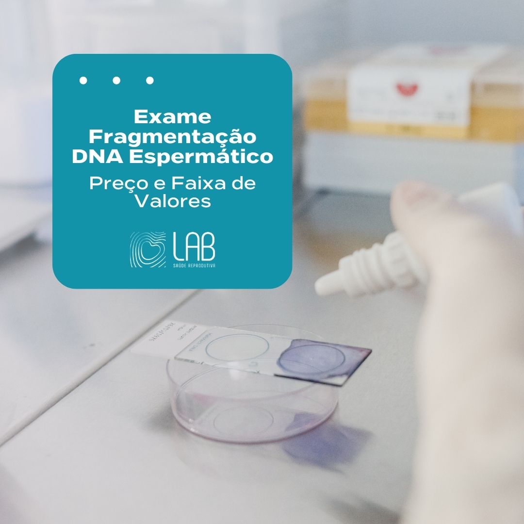 exame fragmentação DNA espermático preço