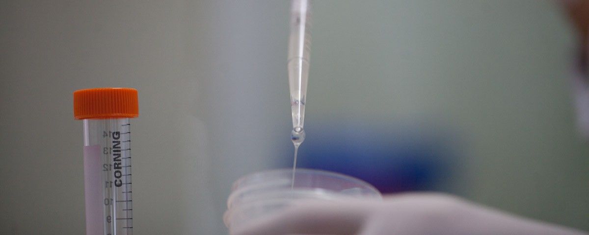 Técnicas de Processamento Seminal para homens HIV positivo